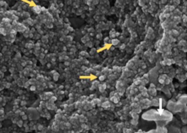 One of the microphotographs of the sample taken from a patient with coronavirus in Cuba. Photo: @cuba_cea/Twitter.