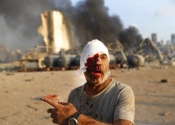 An injured man walks away from the scene of an explosion in Beirut, Lebanon, on Tuesday, August 4, 2020. Photo: Hussein Malla/AP.