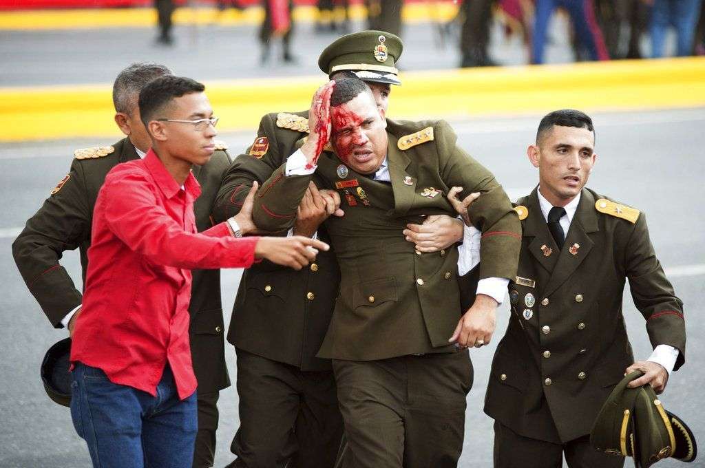 En esta fotografía facilitada por la Agencia de Noticias Xinhua de China, un oficial uniformado sangra de la cabeza debido a un incidente ocurrido cuando el presidente Nicolás Maduro pronunciaba un discurso en Caracas, el sábado 4 de agosto de 2018. Según las autoridades, drones cargados con explosivos estallaron cerca de donde se encontraba el mandatario socialista, que resultó ileso aunque siete personas resultaron heridas.  (Xinhua vía AP)