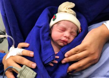 Esta fotografía del 15 de diciembre de 2017 proporcionada por el médico Wellington Andraus muestra a la bebé que nació de una mujer que recibió un trasplante de útero de una donante fallecida en Sao Paulo, Brasil. (Cortesía del doctor Wellington Andraus vía AP)