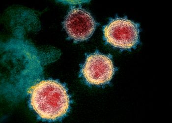 Foto tomada a través de microscopio del coronavirus que causa el COVID-19.