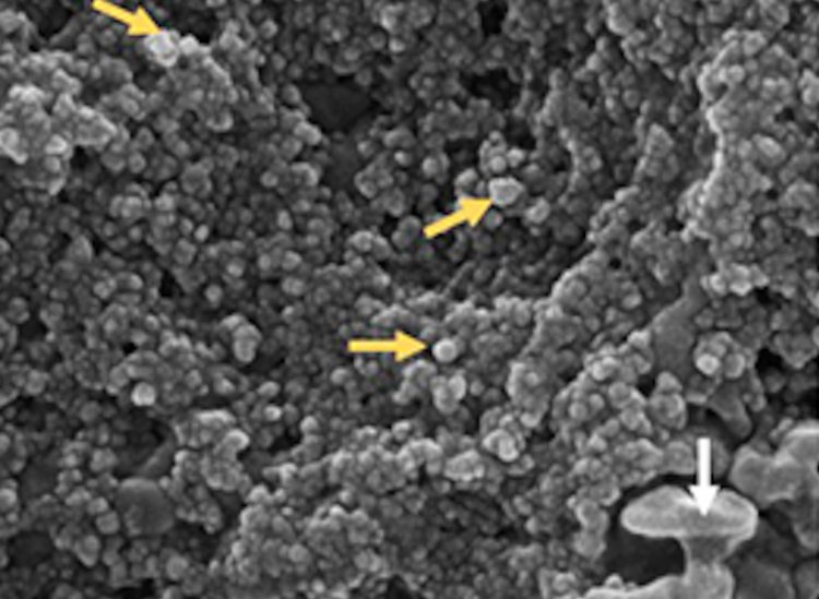 Una de las microfotografías de la muestra tomada a un paciente con coronavirus en Cuba. Foto: @cuba_cea/Twitter.