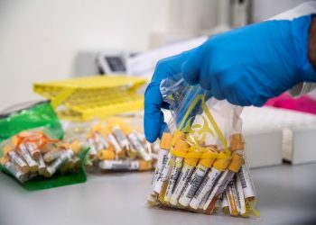 Toma de muestras en un laboratorio italiano. Foto: EFE/EPA/Luca Zennaro/Archivo.