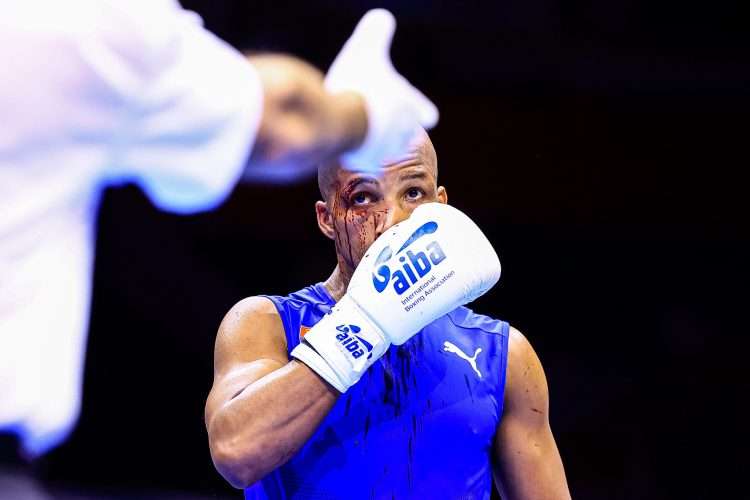 Roniel Iglesias perdió por decisión de los jueces tras sufrir un corte en el rostro en el primer asalto. Foto: insidethegames.biz