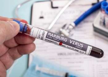Virus de Marburgo. Foto: tomada de Forbes Africa.