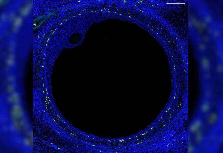 Imagen fluorescente de un folículo ovárico humano. Foto: El Espectador.